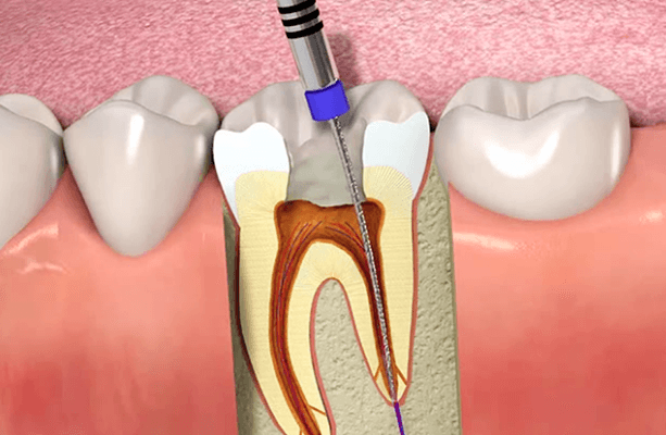 Endodontia